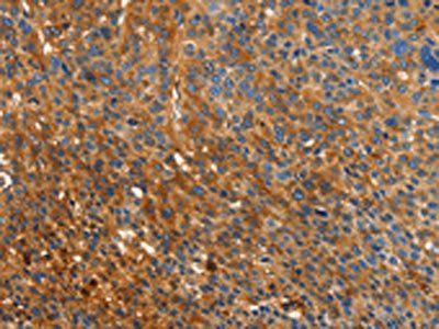 ORM2 antibody