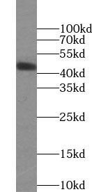 ORM2-Specific antibody
