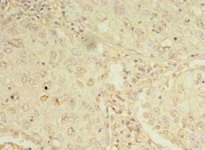 ORMDL1 Antibody