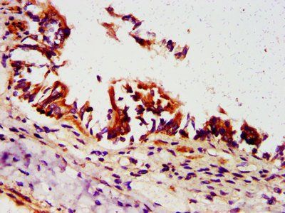 ORMDL3 Antibody