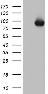 Ornithine Carbamoyltransferase (OTC) antibody