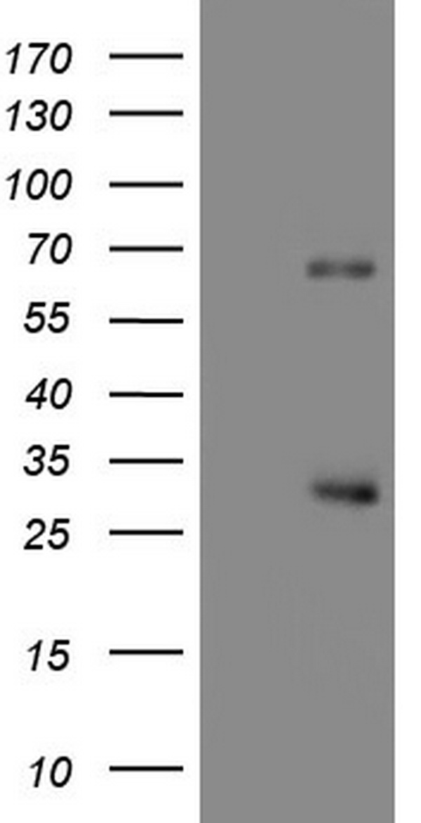 Ornithine Carbamoyltransferase (OTC) antibody