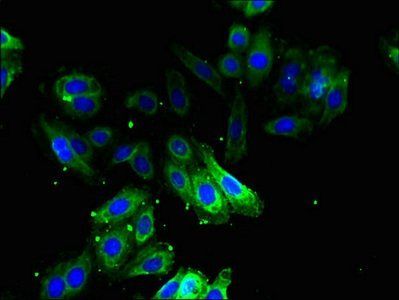 Ornithine decarboxylase antibody