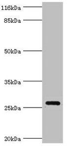 Orofacial cleft 1 candidate gene 1 antibody