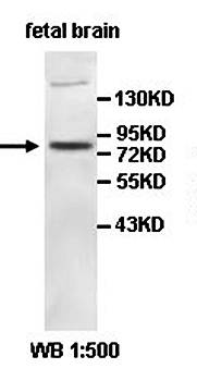 OSBPL11 Rabbit Polyclonal Antibody