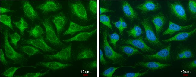 OSBPL6 antibody