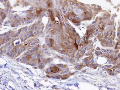 OSBPL6 Rabbit Polyclonal Antibody