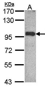OSBPL6 antibody