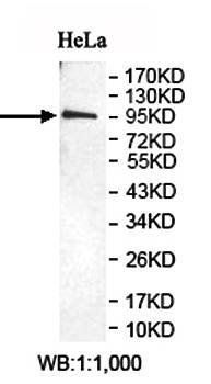 OSBPL6 Rabbit Polyclonal Antibody