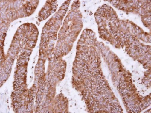 OSGEP antibody