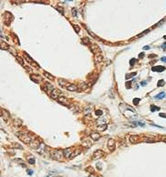 OSGEP Rabbit Polyclonal Antibody