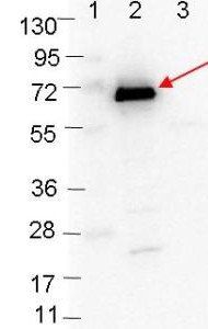 OspC antibody
