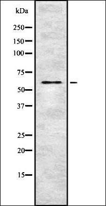 OSR1 (Phospho-Thr185) antibody