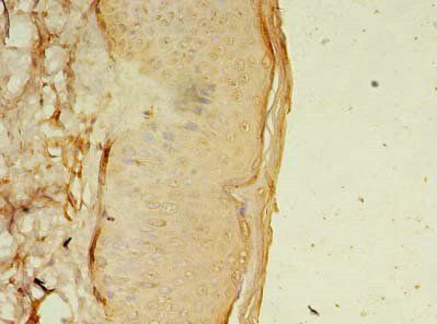 OSR2 Antibody