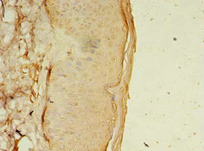 OSR2 antibody