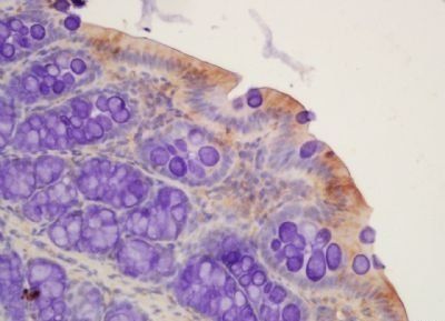 OST-beta Rabbit Polyclonal Antibody