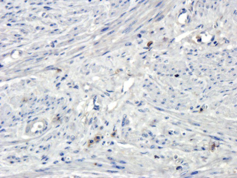 Osteocalcin antibody