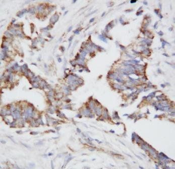 Anti-Osteopontin/SPP1 Antibody