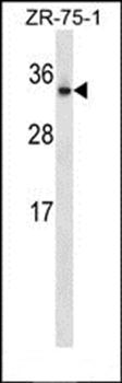 OTUB2 antibody
