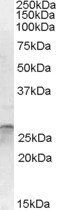 OTUB2 antibody