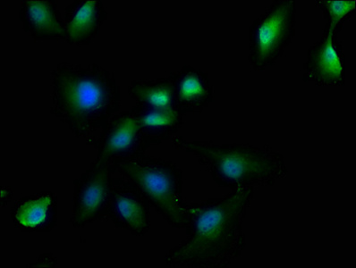 OTUD3 antibody