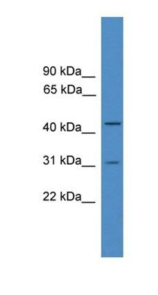 OTUD6A antibody