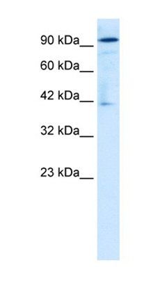 OTUD7B antibody