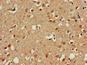 OTX1 Antibody