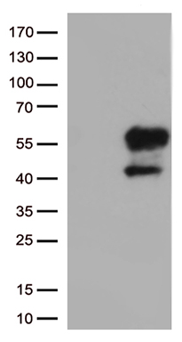 Ovary specific acidic protein (MGARP) antibody