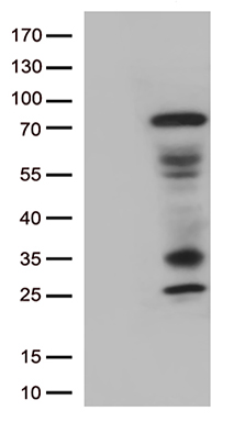 Ovary specific acidic protein (MGARP) antibody