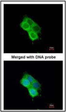 OXSR1 antibody [N1C1]
