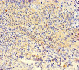 NR1H3 Antibody