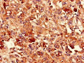 CDH3 Antibody