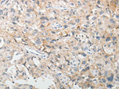 CDH3 Antibody