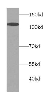 p115, USO1 antibody