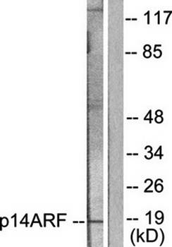 p14 ARF antibody
