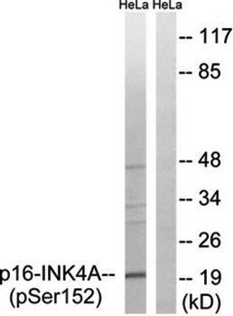 CDKN2A (phospho-Ser152) antibody