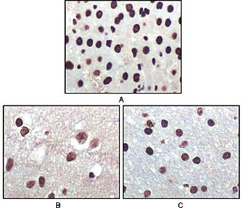 P16 (Mouse and Human) Antibody