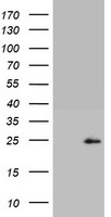 P16(CDKN2A) antibody