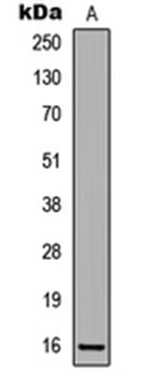 CDKN2A (phospho-S326) antibody