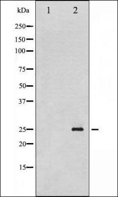 p21 Cip1 (Phospho-Thr145) antibody