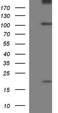 p21 Ras (HRAS) antibody