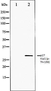 p27 Kip1 (phospho-Thr198) antibody
