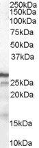 CDKN1B antibody