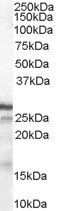 Goat anti-P27KIP1 / CDKN1B (C Terminus) Antibody