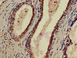P2RX1 Antibody