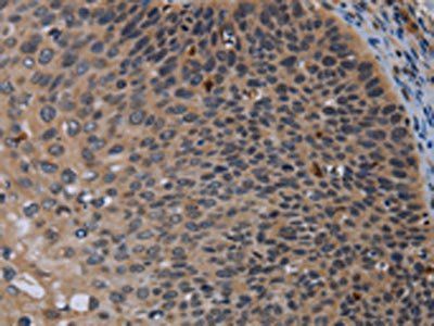 P2RX2 Antibody