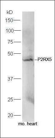 P2RX5 antibody