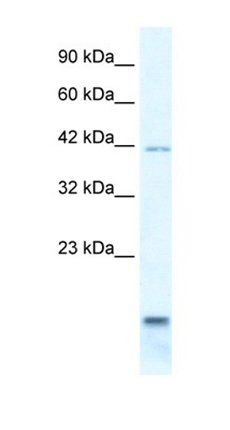 P2RX6 antibody