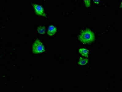 P2RX7 Antibody